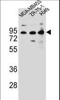 CTTNBP2NL Antibody - CTTNBP2NL Antibody western blot of MDA-MB453,ZR-75-1,A549 cell line lysates (35 ug/lane). The CTTNBP2NL antibody detected the CTTNBP2NL protein (arrow).