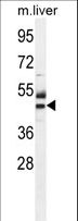 CTU1 Antibody - ATPBD3 Antibody western blot of mouse liver tissue lysates (35 ug/lane). The ATPBD3 antibody detected the ATPBD3 protein (arrow).