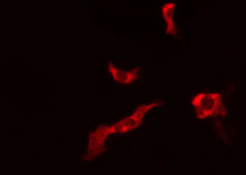 CTU1 Antibody - Staining LOVO cells by IF/ICC. The samples were fixed with PFA and permeabilized in 0.1% Triton X-100, then blocked in 10% serum for 45 min at 25°C. The primary antibody was diluted at 1:200 and incubated with the sample for 1 hour at 37°C. An Alexa Fluor 594 conjugated goat anti-rabbit IgG (H+L) antibody, diluted at 1/600, was used as secondary antibody.