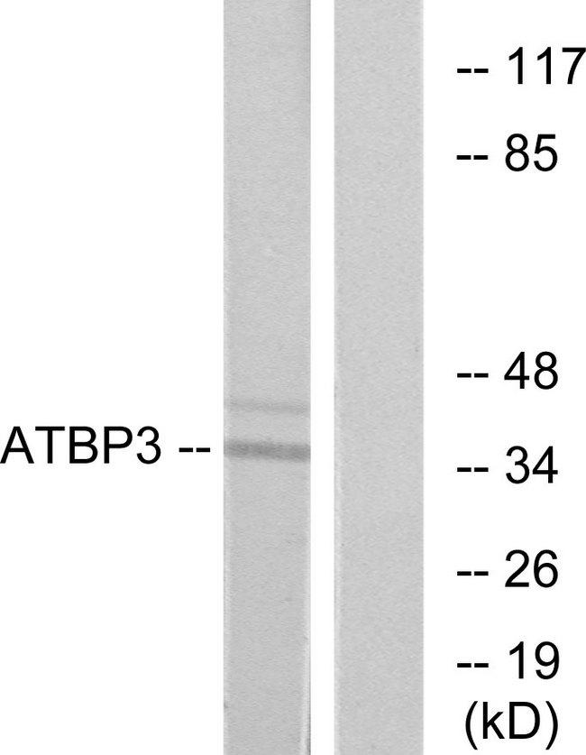 CTU1 Antibody - Western blot analysis of extracts from LOVO cells, using ATBP3 antibody.