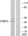 CTU1 Antibody - Western blot analysis of extracts from LOVO cells, using ATBP3 antibody.
