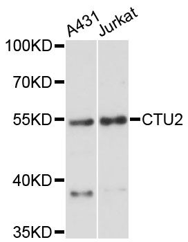 CTU2 Antibody - Western blot analysis of extracts of various cell lines, using CTU2 antibody at 1:3000 dilution. The secondary antibody used was an HRP Goat Anti-Rabbit IgG (H+L) at 1:10000 dilution. Lysates were loaded 25ug per lane and 3% nonfat dry milk in TBST was used for blocking. An ECL Kit was used for detection and the exposure time was 90s.