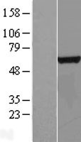 CTU2 Protein - Western validation with an anti-DDK antibody * L: Control HEK293 lysate R: Over-expression lysate
