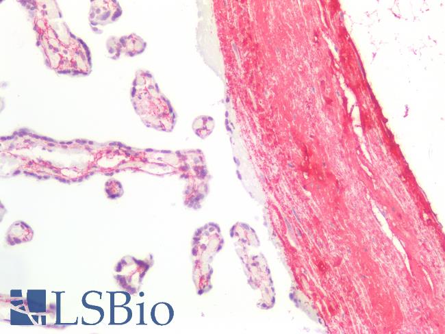 CTx-I Antibody - Human Placental Collagen: Formalin-Fixed, Paraffin-Embedded (FFPE)