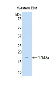 CUBN / Cubilin Antibody - Western blot of recombinant CUBN / Cubilin.  This image was taken for the unconjugated form of this product. Other forms have not been tested.