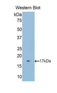 CUBN / Cubilin Antibody - Western blot of recombinant CUBN / Cubilin.  This image was taken for the unconjugated form of this product. Other forms have not been tested.