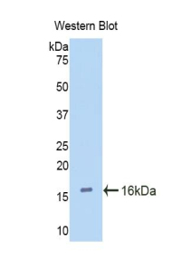 CUBN / Cubilin Antibody - Western blot of recombinant CUBN / Cubilin.  This image was taken for the unconjugated form of this product. Other forms have not been tested.