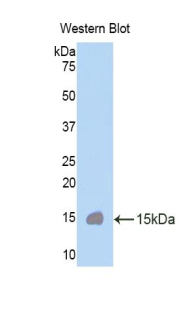 CUBN / Cubilin Antibody - Western blot of CUBN / Cubilin antibody.