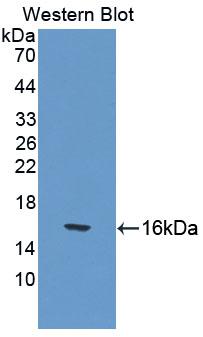 CUBN / Cubilin Antibody - Western blot of CUBN / Cubilin antibody.