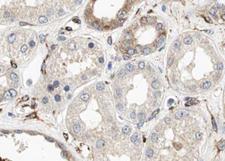 CUBN / Cubilin Antibody - 1:100 staining human kidney tissue by IHC-P. The sample was formaldehyde fixed and a heat mediated antigen retrieval step in citrate buffer was performed. The sample was then blocked and incubated with the antibody for 1.5 hours at 22°C. An HRP conjugated goat anti-rabbit antibody was used as the secondary.