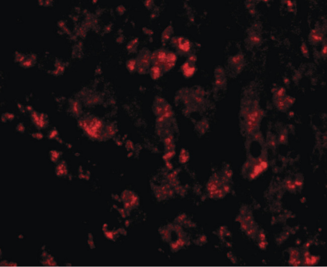 CUEDC1 Antibody - Immunofluorescence of CUEDC1 in human liver tissue with CUEDC1 antibody at 20 ug/ml.