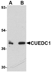 CUEDC1 Antibody - Western blot of CUEDC1 in rat liver tissue lysate with CUEDC1 antibody at (A) 0.5 and (B) 1 ug/ml