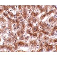 CUEDC1 Antibody - Immunohistochemistry of CUEDC1 in human liver tissue with CUEDC1 antibody at 2 µg/mL.