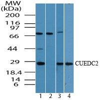 CUEDC2 Antibody - Western blot of CUEDC2 in MCF7 cell lysate in the 1) absence and 2) presence of immunizing peptide, 3) NIH 3T3 cell lysate, and 4) human spleen cell lysate using Polyclonal Antibody to CUEDC2 at 0.5 ug/ml.