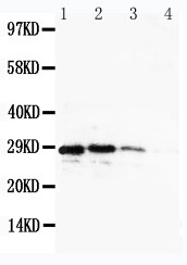 CUEDC2 Antibody - WB of CUEDC2 antibody. Recombinant Protein Detection Source:. E.coli derived -recombinant human CuEDC2, 28.9KD. (162aa tag+ N197-H287). Lane 1: Recombinant Human CuEDC2 Protein 10ng. Lane 2: Recombinant Human CuEDC2 Protein 5ng. Lane 3: Recombinant Human CuEDC2 Protein 2.5ng. Lane 4: Recombinant Human CuEDC2 Protein 1.25ng.