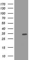 CUEDC2 Antibody - HEK293T cells were transfected with the pCMV6-ENTRY control (Left lane) or pCMV6-ENTRY CUEDC2 (Right lane) cDNA for 48 hrs and lysed. Equivalent amounts of cell lysates (5 ug per lane) were separated by SDS-PAGE and immunoblotted with anti-CUEDC2.