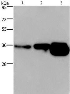 CUEDC2 Antibody - Western blot analysis of Human breast infiltrative duct and fetal brain tissue, mouse brain tissue, using CUEDC2 Polyclonal Antibody at dilution of 1:600.
