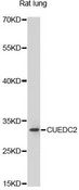 CUEDC2 Antibody - Western blot analysis of extracts of rat lung, using CUEDC2 antibody at 1:1000 dilution. The secondary antibody used was an HRP Goat Anti-Rabbit IgG (H+L) at 1:10000 dilution. Lysates were loaded 25ug per lane and 3% nonfat dry milk in TBST was used for blocking. An ECL Kit was used for detection and the exposure time was 90s.