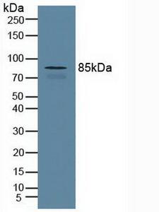 CUL1 / Cullin 1 Antibody - Western Blot;Sample: Human Serum.