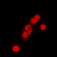 CUL1 / Cullin 1 Antibody - Immunofluorescent analysis of Cullin 1 staining in HeLa cells. Formalin-fixed cells were permeabilized with 0.1% Triton X-100 in TBS for 5-10 minutes and blocked with 3% BSA-PBS for 30 minutes at room temperature. Cells were probed with the primary antibody in 3% BSA-PBS and incubated overnight at 4 C in a humidified chamber. Cells were washed with PBST and incubated with a DyLight 594-conjugated secondary antibody (red) in PBS at room temperature in the dark. DAPI was used to stain the cell nuclei (blue).