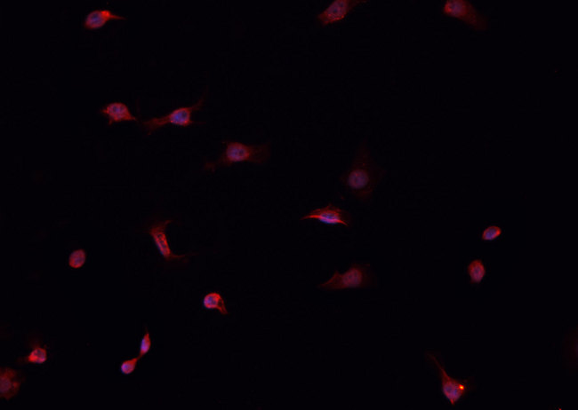 CUL1 / Cullin 1 Antibody - Staining HeLa cells by IF/ICC. The samples were fixed with PFA and permeabilized in 0.1% Triton X-100, then blocked in 10% serum for 45 min at 25°C. The primary antibody was diluted at 1:200 and incubated with the sample for 1 hour at 37°C. An Alexa Fluor 594 conjugated goat anti-rabbit IgG (H+L) Ab, diluted at 1/600, was used as the secondary antibody.