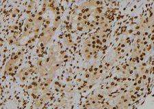 CUL1 / Cullin 1 Antibody - 1:100 staining human kidney tissue by IHC-P. The sample was formaldehyde fixed and a heat mediated antigen retrieval step in citrate buffer was performed. The sample was then blocked and incubated with the antibody for 1.5 hours at 22°C. An HRP conjugated goat anti-rabbit antibody was used as the secondary.