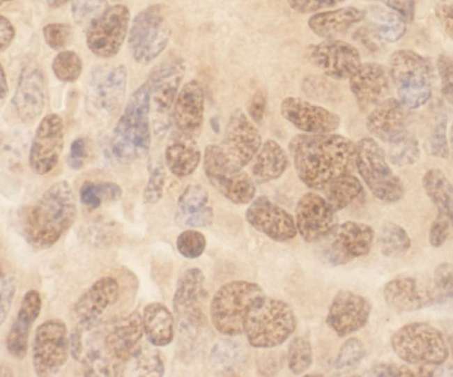 CUL2 / Cullin 2 Antibody - Detection of Mouse Cul2 by Immunohistochemistry. Sample: FFPE section of mouse teratoma. Antibody: Affinity purified rabbit anti-Cul2 used at a dilution of 1:100.