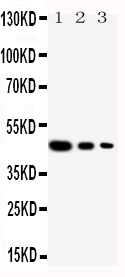 CUL2 / Cullin 2 Antibody - Anti-Cullin 2 antibody, Western blottingRecombinant Protein Detection Source: E. coli derived -recombinant human Cul2, 46. 5KD (162aa tag+L150-Y394)Lane 1: Recombinant Human Cul2 Protein 10ng Lane 2: Recombinant Human Cul2 Protein 5ng Lane 3: Recombinant Human Cul2 Protein 2. 5ng