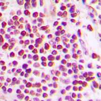 CUL2 / Cullin 2 Antibody - Immunohistochemical analysis of Cullin 2 staining in human tonsil formalin fixed paraffin embedded tissue section. The section was pre-treated using heat mediated antigen retrieval with sodium citrate buffer (pH 6.0). The section was then incubated with the antibody at room temperature and detected using an HRP conjugated compact polymer system. DAB was used as the chromogen. The section was then counterstained with hematoxylin and mounted with DPX.
