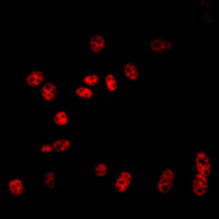 CUL2 / Cullin 2 Antibody - Immunofluorescent analysis of Cullin 2 staining in NIH3T3 cells. Formalin-fixed cells were permeabilized with 0.1% Triton X-100 in TBS for 5-10 minutes and blocked with 3% BSA-PBS for 30 minutes at room temperature. Cells were probed with the primary antibody in 3% BSA-PBS and incubated overnight at 4 C in a humidified chamber. Cells were washed with PBST and incubated with a DyLight 594-conjugated secondary antibody (red) in PBS at room temperature in the dark. DAPI was used to stain the cell nuclei (blue).