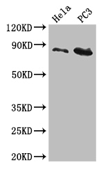 CUL2 / Cullin 2 Antibody - Positive WB detected in:Hela whole cell lysate,PC3 whole cell lysate;All lanes:CUL2 antibody at 5ug/ml;Secondary;Goat polyclonal to rabbit IgG at 1/50000 dilution;Predicted band size: 87,90 kDa;Observed band size: 87 kDa;