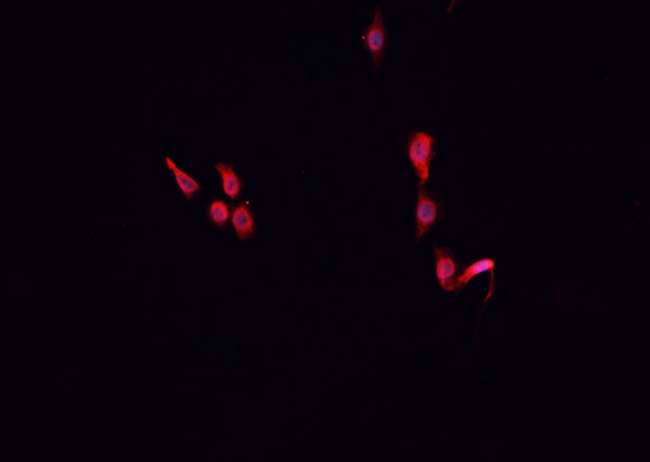 CUL2 / Cullin 2 Antibody - Staining LOVO cells by IF/ICC. The samples were fixed with PFA and permeabilized in 0.1% Triton X-100, then blocked in 10% serum for 45 min at 25°C. The primary antibody was diluted at 1:200 and incubated with the sample for 1 hour at 37°C. An Alexa Fluor 594 conjugated goat anti-rabbit IgG (H+L) Ab, diluted at 1/600, was used as the secondary antibody.