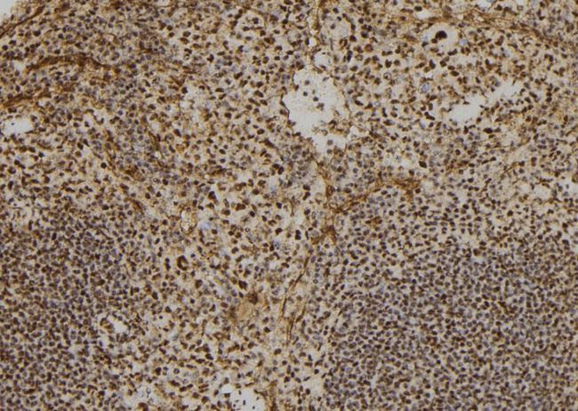 CUL2 / Cullin 2 Antibody - 1:100 staining mouse spleen tissue by IHC-P. The sample was formaldehyde fixed and a heat mediated antigen retrieval step in citrate buffer was performed. The sample was then blocked and incubated with the antibody for 1.5 hours at 22°C. An HRP conjugated goat anti-rabbit antibody was used as the secondary.