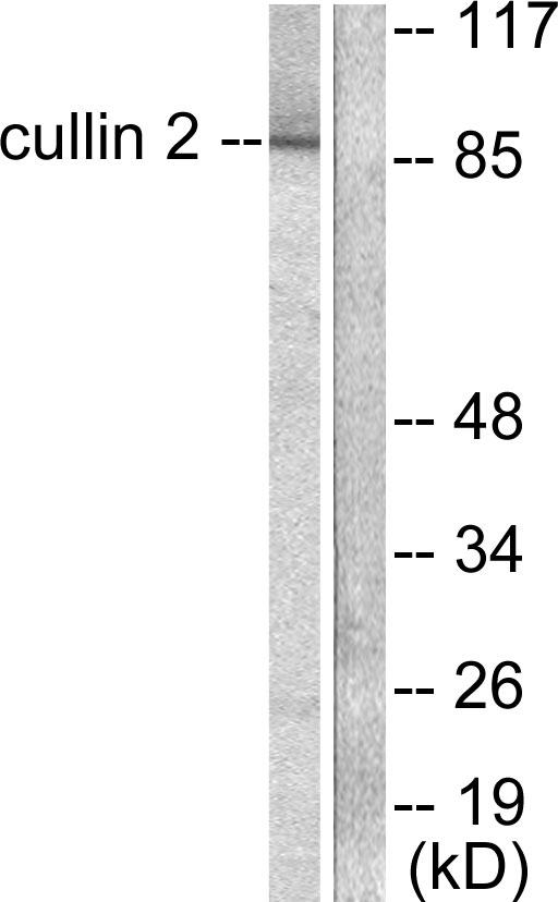 CUL2 / Cullin 2 Antibody - Western blot analysis of extracts from LOVO cells, using Cullin 2 antibody.