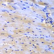 CUL2 / Cullin 2 Antibody - Immunohistochemistry of paraffin-embedded Mouse heart using CUL2 Polyclonal Antibody at dilution of 1:200 (40x lens).