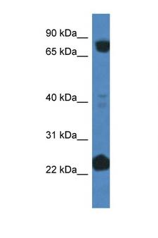 CUL3 / Cullin 3 Antibody - CUL3 / Cullin 3 antibody Western blot of Fetal Liver lysate. Antibody concentration 1 ug/ml. This image was taken for the unconjugated form of this product. Other forms have not been tested.