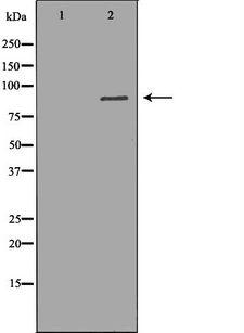 CUL3 / Cullin 3 Antibody - Western blot analysis of Jurkat lysate using CUL3 antibody. The lane on the left is treated with the antigen-specific peptide.