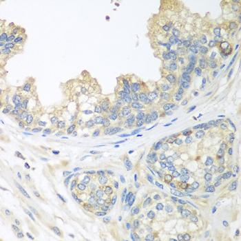 CUL3 / Cullin 3 Antibody - Immunohistochemistry of paraffin-embedded Human prostate using CUL3 Polyclonal Antibody at dilution of 1:100 (40x lens).