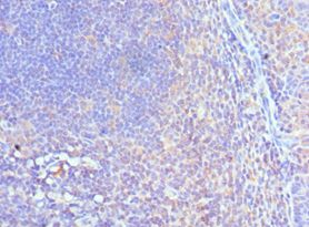 CUL5 / Cullin-5 Antibody - Immunohistochemistry of paraffin-embedded human tonsil using antibody 1:100 dilution.