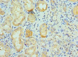 CUL5 / Cullin-5 Antibody - Immunohistochemistry of paraffin-embedded human kidney using antibody at 1:100 dilution.