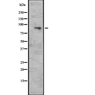 CUL5 / Cullin-5 Antibody - Western blot analysis of CUL5 expression in HeLa cells lysate. The lane on the left is treated with the antigen-specific peptide.