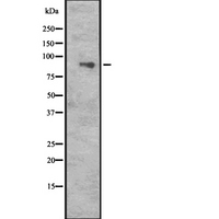 CUL5 / Cullin-5 Antibody - Western blot analysis of CUL5 expression in HeLa cells lysate. The lane on the left is treated with the antigen-specific peptide.