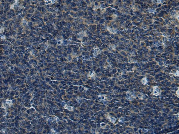 CUL5 / Cullin-5 Antibody - Immunohistochemistry of paraffin-embedded Human tonsil tissue  using CUL5 Polyclonal Antibody at dilution of 1:55(×200)