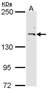 CUL7 Antibody - Sample (30 ug of whole cell lysate). A: Molt-4 . 7.5% SDS PAGE. CUL7 antibody diluted at 1:1000.