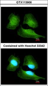 CUL7 Antibody - Immunofluorescence of methanol-fixed HeLa using Cullin 7 antibody at 1:200 dilution.