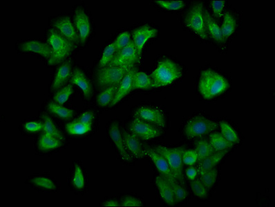 CUL7 Antibody - Immunofluorescence staining of HepG2 cells diluted at 1:200, counter-stained with DAPI. The cells were fixed in 4% formaldehyde, permeabilized using 0.2% Triton X-100 and blocked in 10% normal Goat Serum. The cells were then incubated with the antibody overnight at 4°C.The Secondary antibody was Alexa Fluor 488-congugated AffiniPure Goat Anti-Rabbit IgG (H+L).