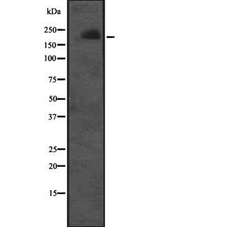 CUL7 Antibody - Western blot analysis of CUL7 expression in Molt-4 cells lysate. The lane on the left is treated with the antigen-specific peptide.