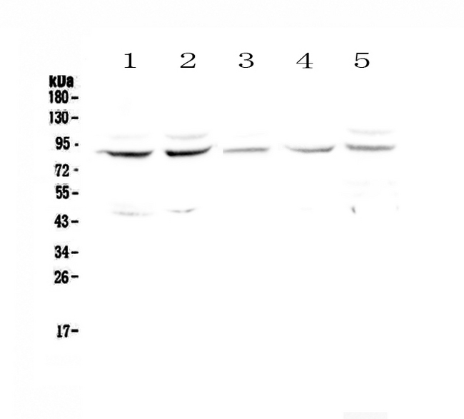 Cullin 4A / CUL4A Antibody - Western blot - Anti-Cullin 4a Picoband antibody
