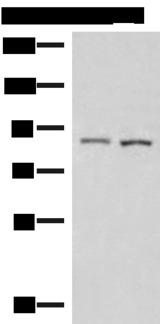 Cullin 4A / CUL4A Antibody - Western blot analysis of 231 and HepG2 cell lysates  using CUL4A Polyclonal Antibody at dilution of 1:600