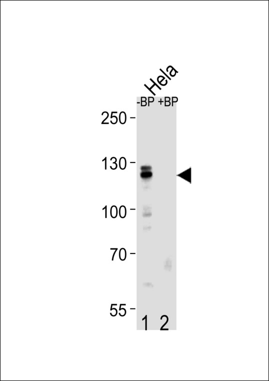Cullin 4B / CUL4B Antibody - Western blot of CUL4B Antibody antibody pre-incubated without(lane 1) and with(lane 2) blocking peptide in HeLa cell line lysate. CUL4B Antibody (arrow) was detected using the purified antibody.